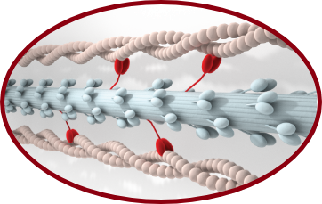 Heart Muscle Excessive Bridging